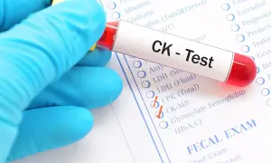 Rękawiczka w niebieskiej rękawiczce trzyma probówkę z krwią do testu CK, który może oznaczać kinazę kreatynową.