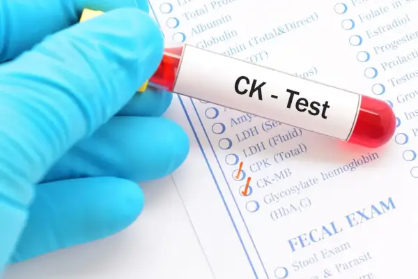 Rękawiczka w niebieskiej rękawiczce trzyma probówkę z krwią do testu CK, który może oznaczać kinazę kreatynową.